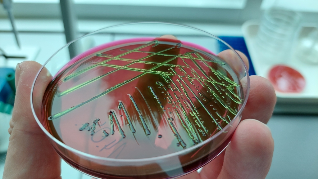 E. coli petri tassil.jpg