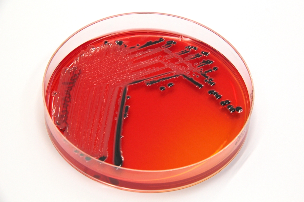 LABRIS_Salmonella_XLD.jpg