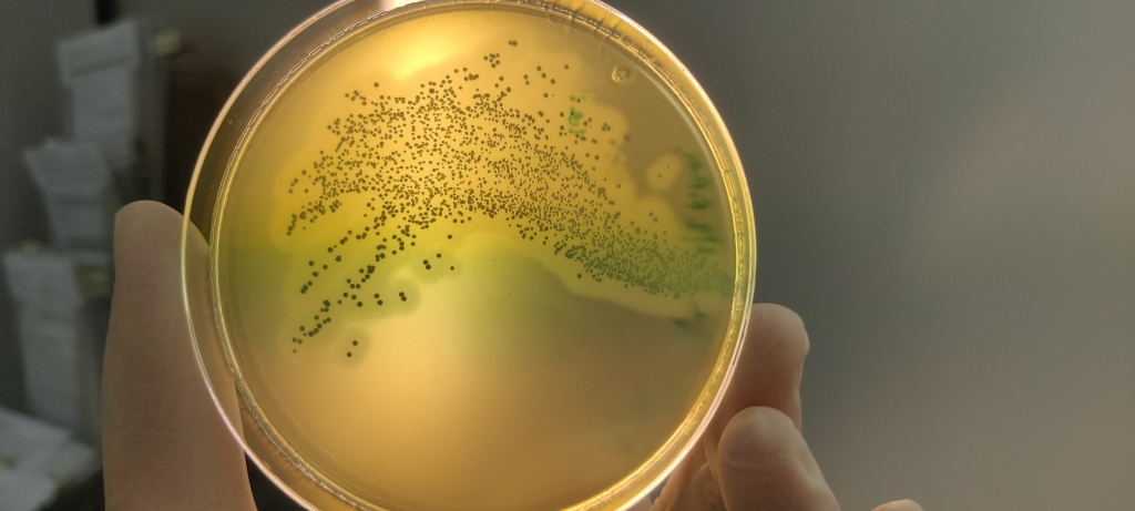 Listeria monocytogenes petri tassil.jpg