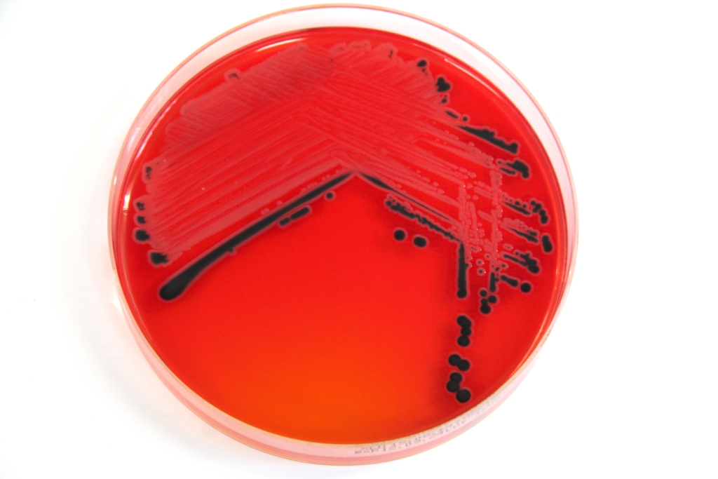 Salmonella laboris.jpg
